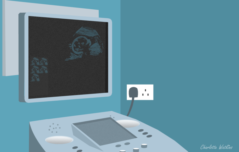 13 weeks pregnant - scan machine