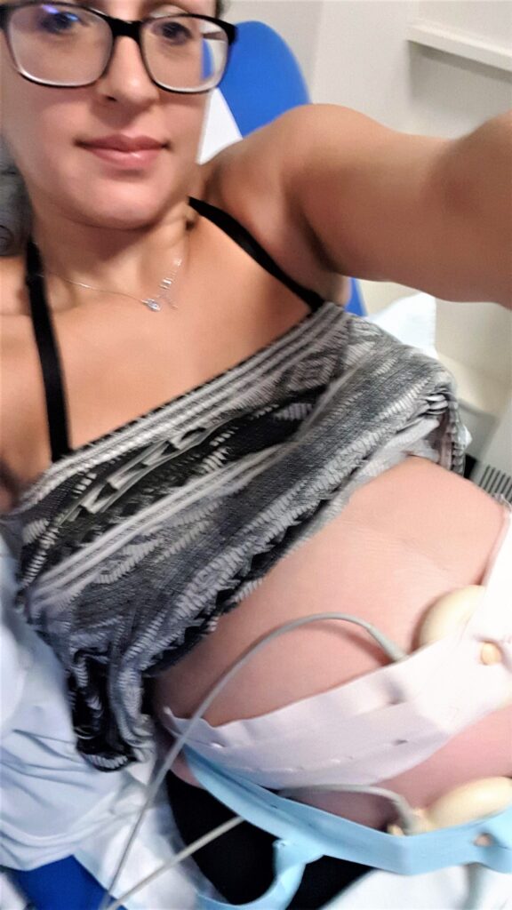 Hooked up to a CTG measuring contractions