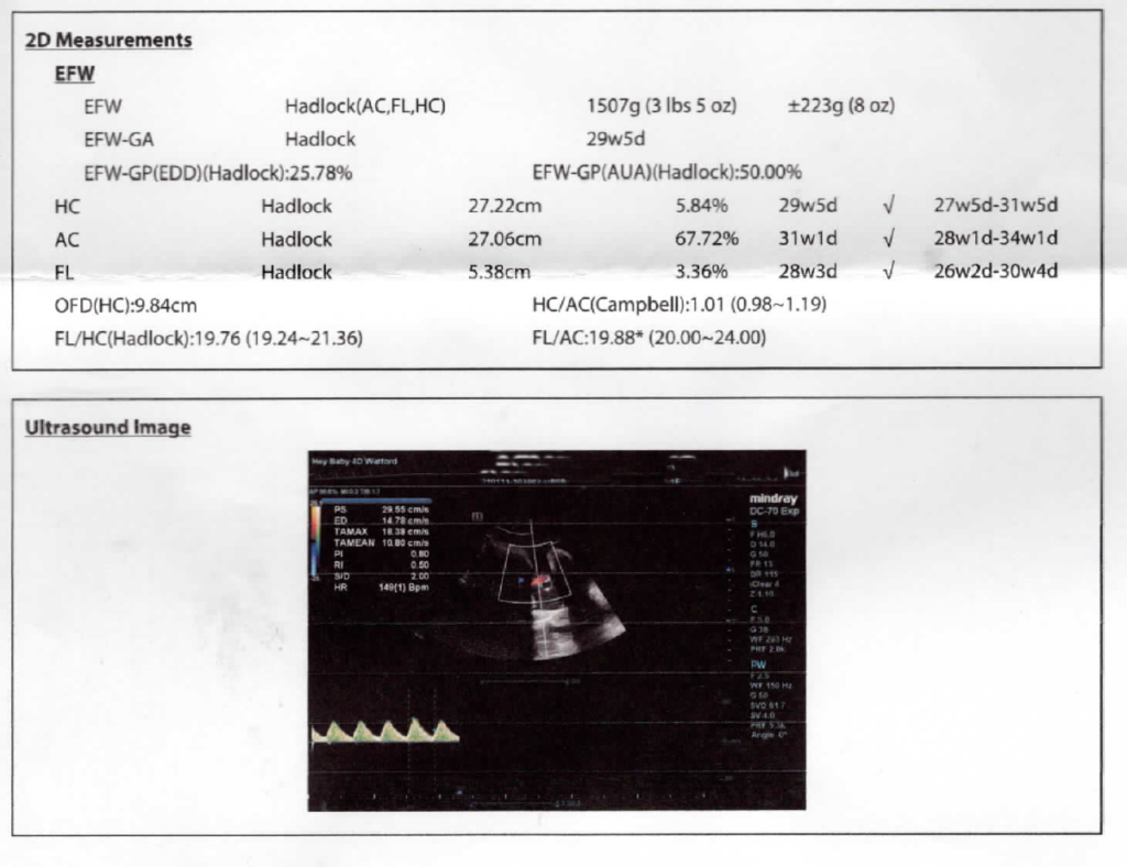 2D measurements and ultrasound image at growth scan