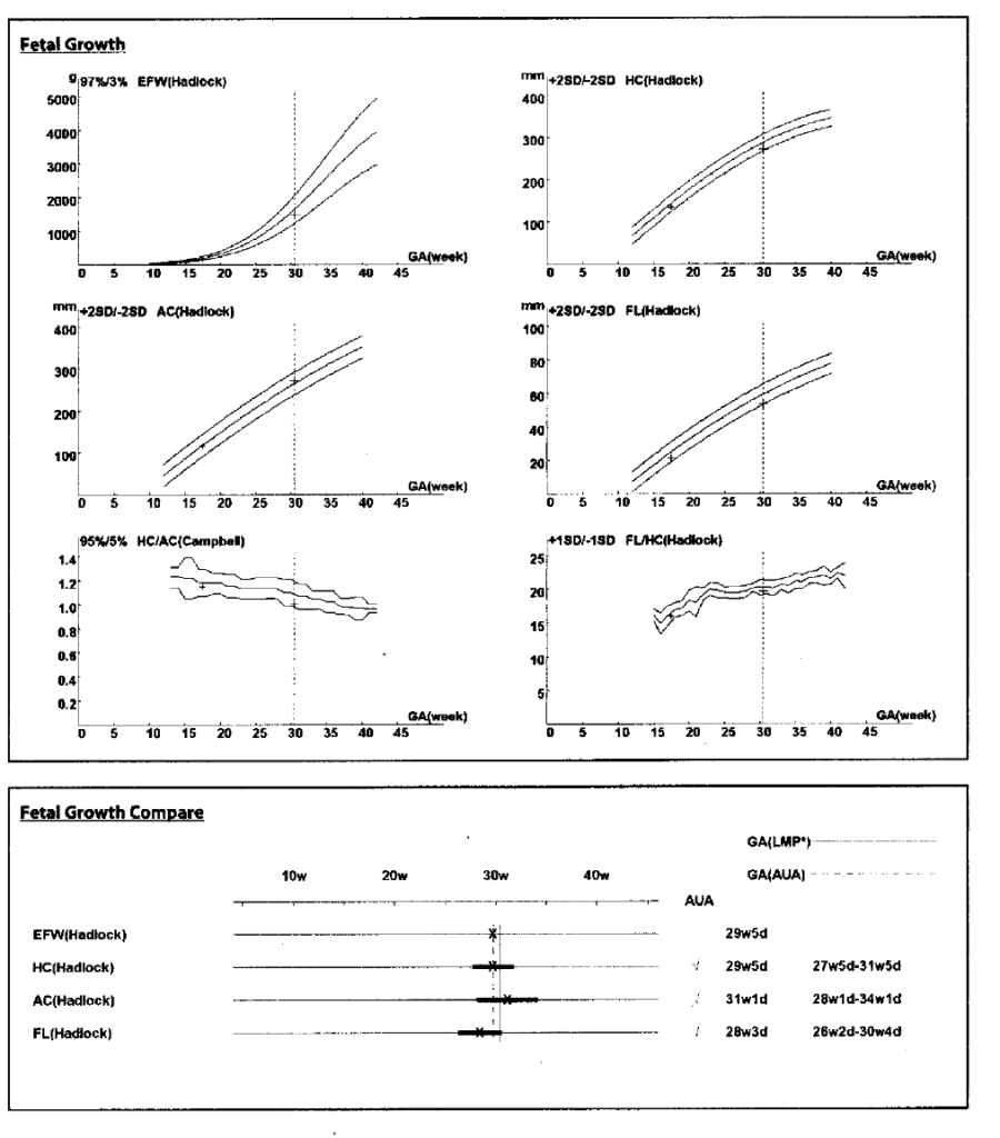 Foetal growth and foetal growth compare