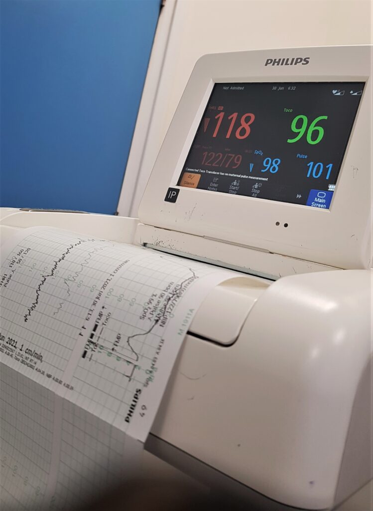 Starting to feel some tightenings!