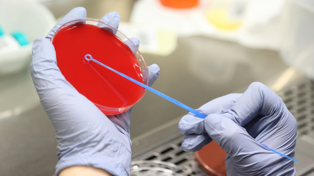 Bacterial vaginosis in pregnancy - doctor tests