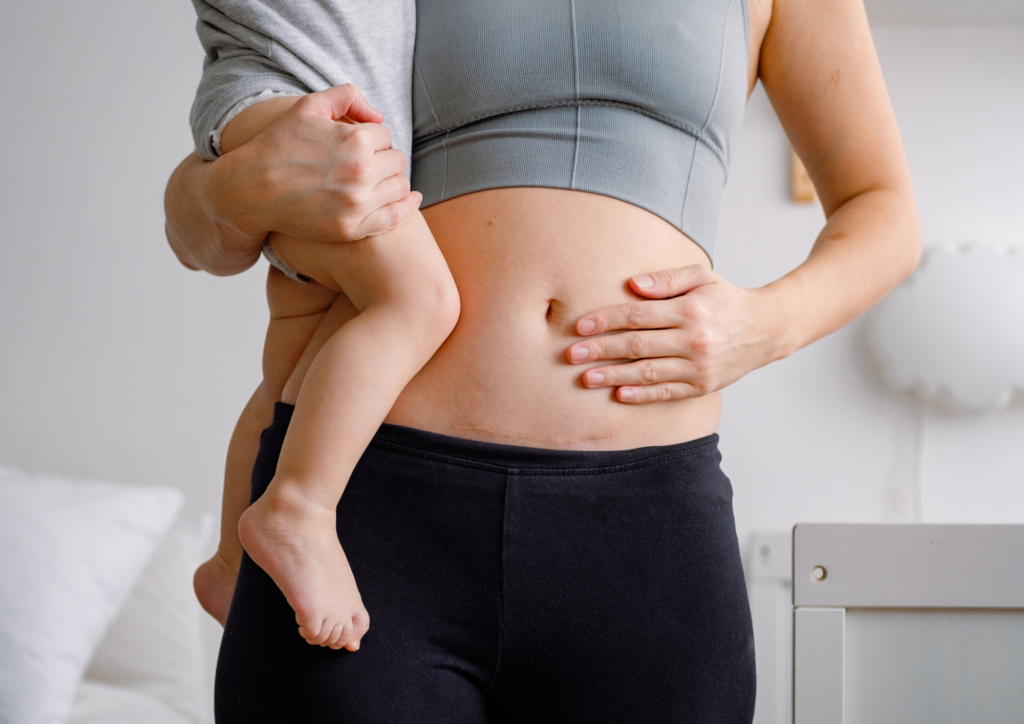 The best workout clothes after C Section