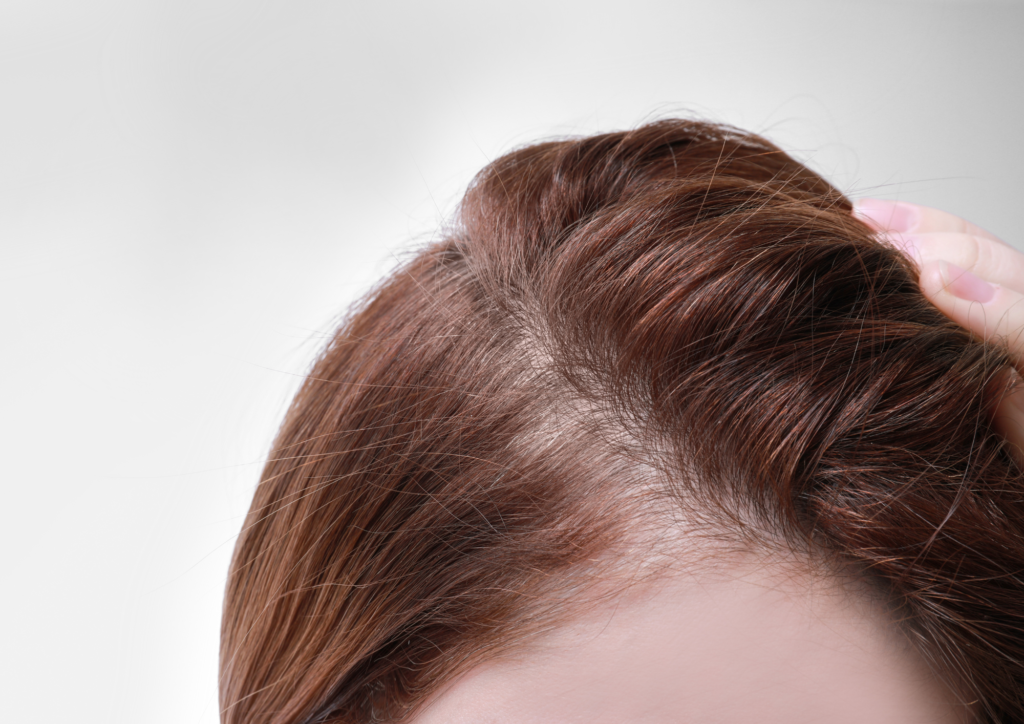 Home remedies for hair fall after pregnancy - treatment options for hair loss